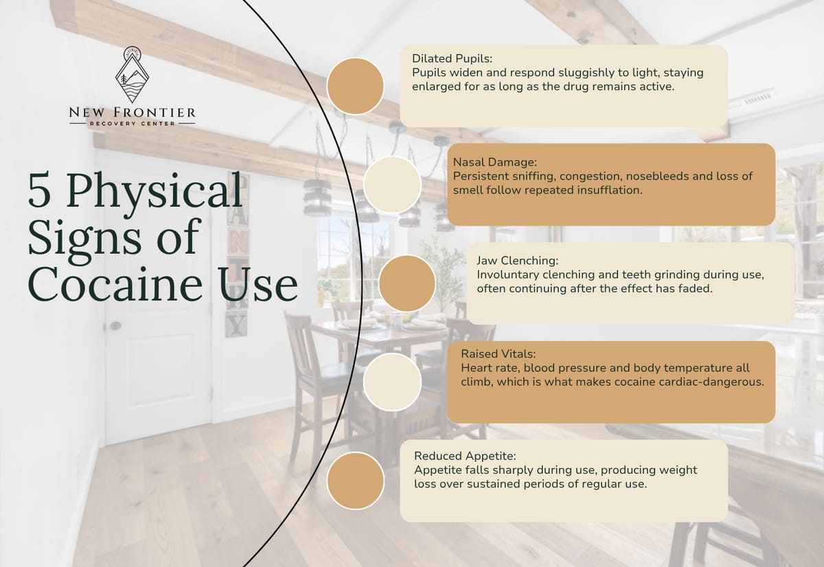 Five physical signs of cocaine use: dilated pupils, nasal damage, jaw clenching, raised vitals, and reduced appetite.