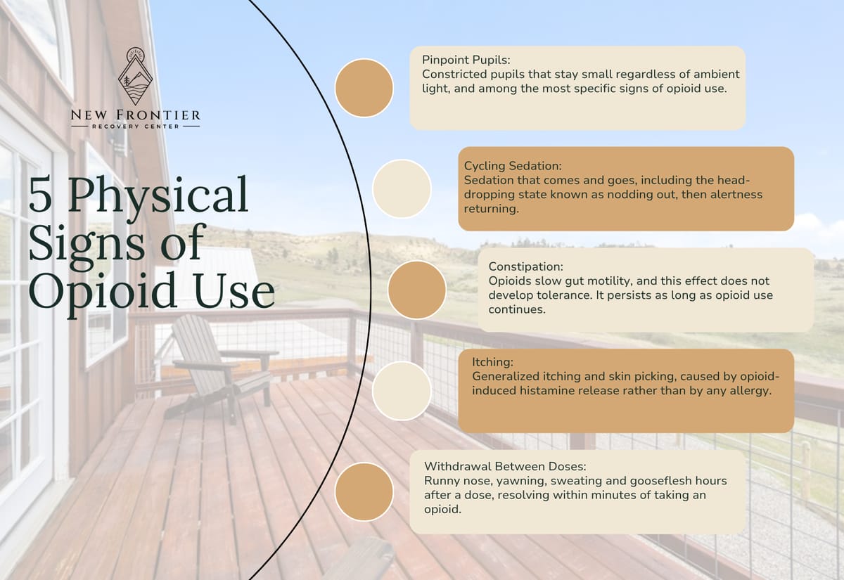 Five physical signs of opioid use: pinpoint pupils, cycling sedation, constipation, itching, and withdrawal between doses.